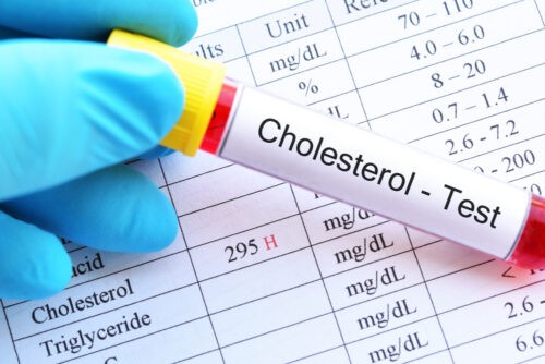 Blood Tests in Pittsburgh