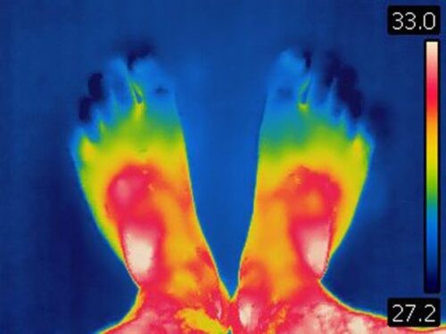 Temperature scan of the feet showing problems with circulation