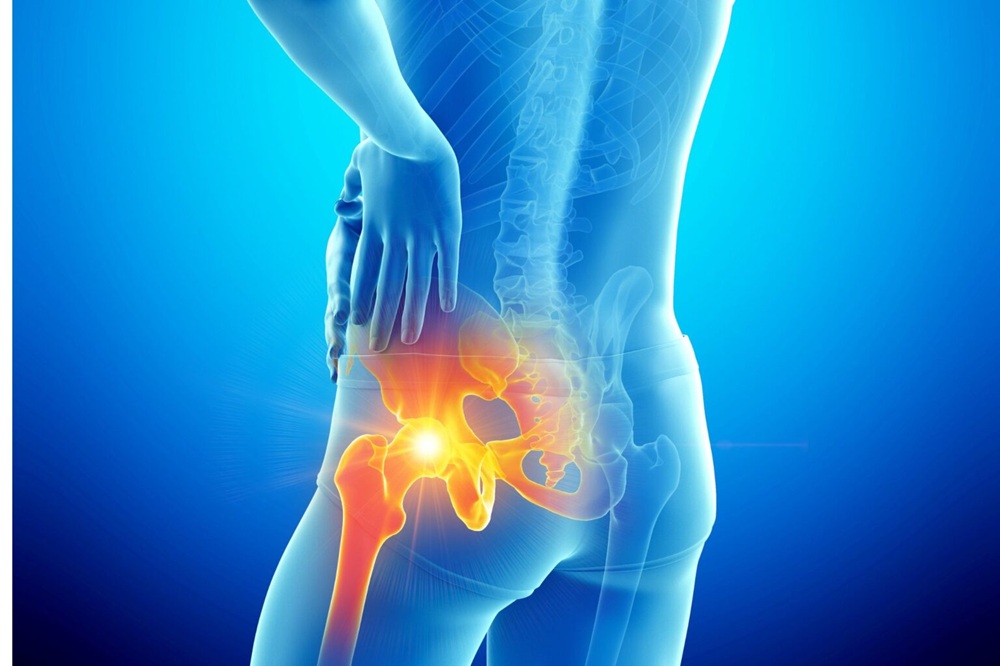 Image of hip pain