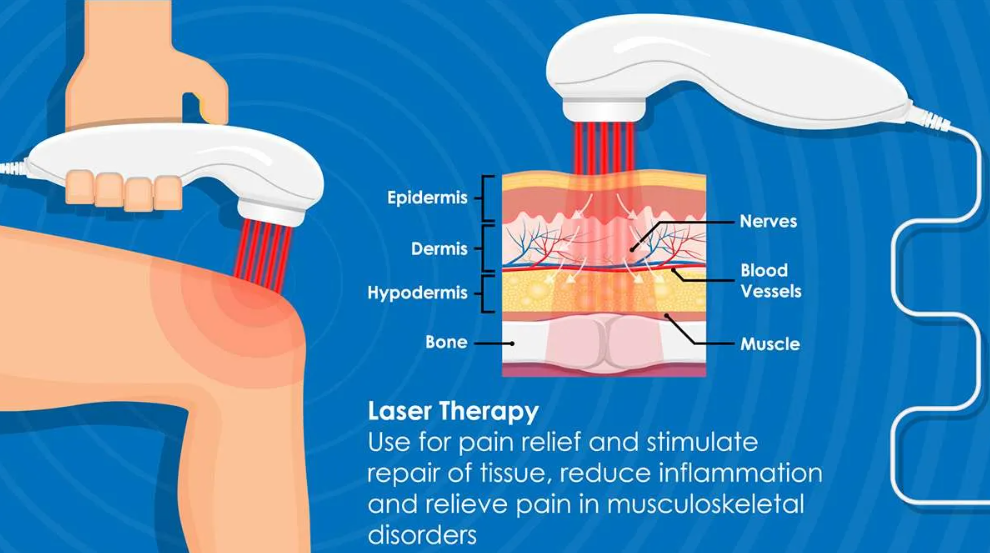 Laser Therapy in Bethel Park Chronic Conditions Center