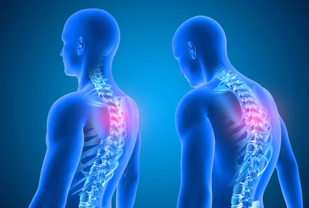 Pinched nerve relief in Bethel Park
