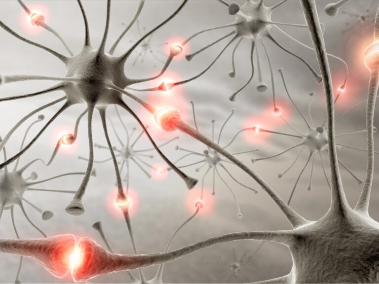 Nerve cells showing neuropathy